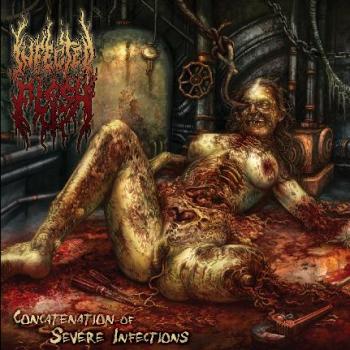 Infected Flesh: Concatenation Of Severe Infec...